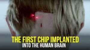 the first chip implanted into the human brain