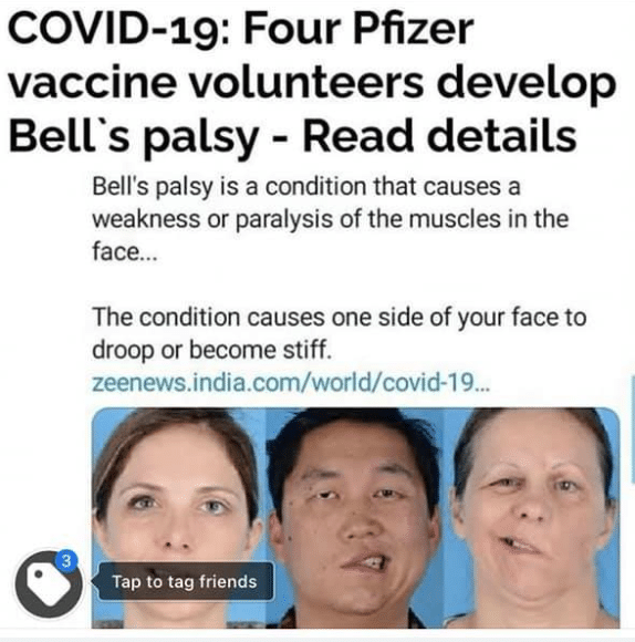 Four Pfizer vaccine volunteers develop Bell's Palsy