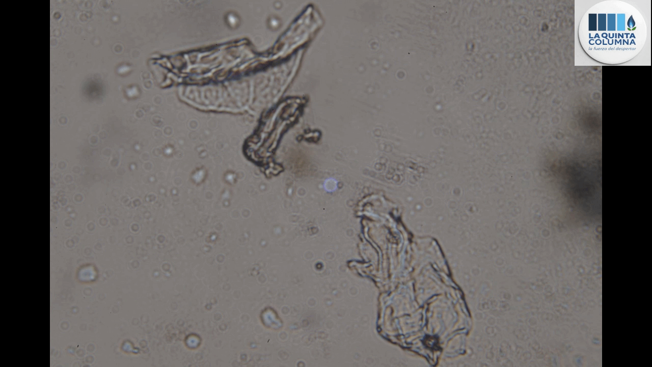 nanosheet in rainwater under microscope2