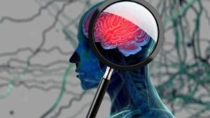 reversing Alzheimer's Disease with natural treatments - Magnifying glass brain