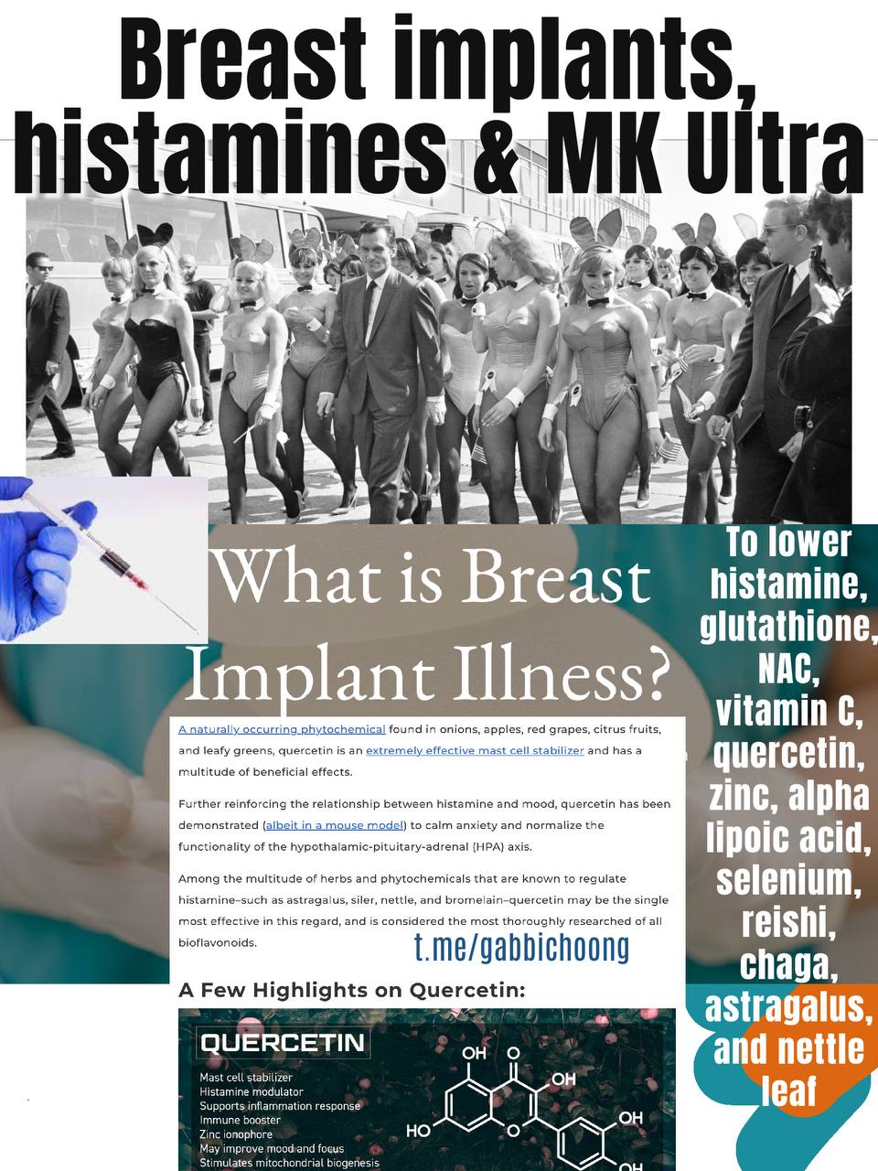 Breast implants, histamines, and MK Ultra - Our mental states are intimately intertwined with the inflammation in our bodies
