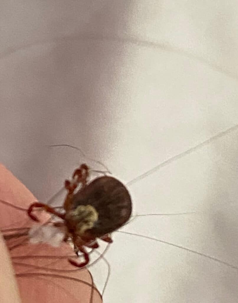 A tick from my scalp - Een teek uit mijn schedel - Eleyna Matthews - Eindtijdnieuws.com A tick from my scalp - Een teek uit mijn schedel - Eleyna Matthews